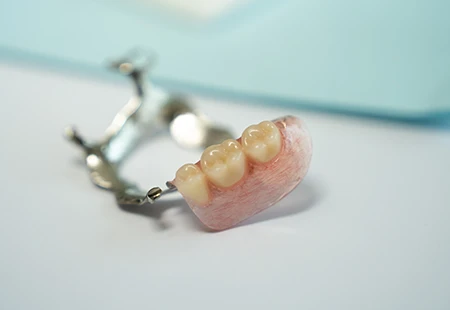 The Difference - Garden Ridge Center For Dentistry