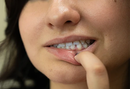 Periodontium - Garden Ridge Center For Dentistry