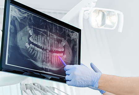3D Radiography - Garden Ridge Center For Dentistry