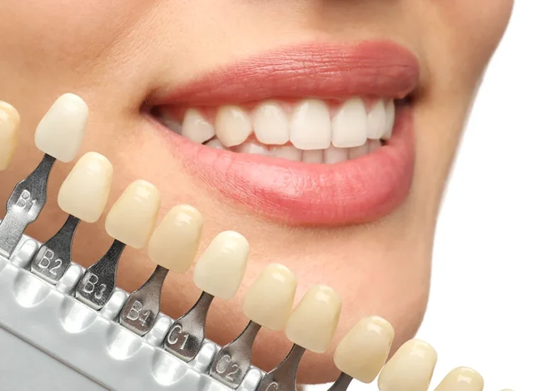 Enhance Your Confidence Through Cosmetic Dentistry - Garden Ridge Center For Dentistry