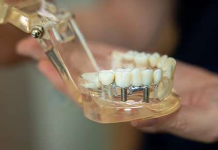 Natural Look & Feel - Garden Ridge Center For Dentistry