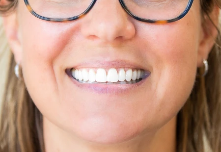 Are you looking for quick and effective teeth whitening? - Garden Ridge Center For Dentistry